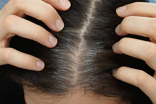 permanent solution for grey hair