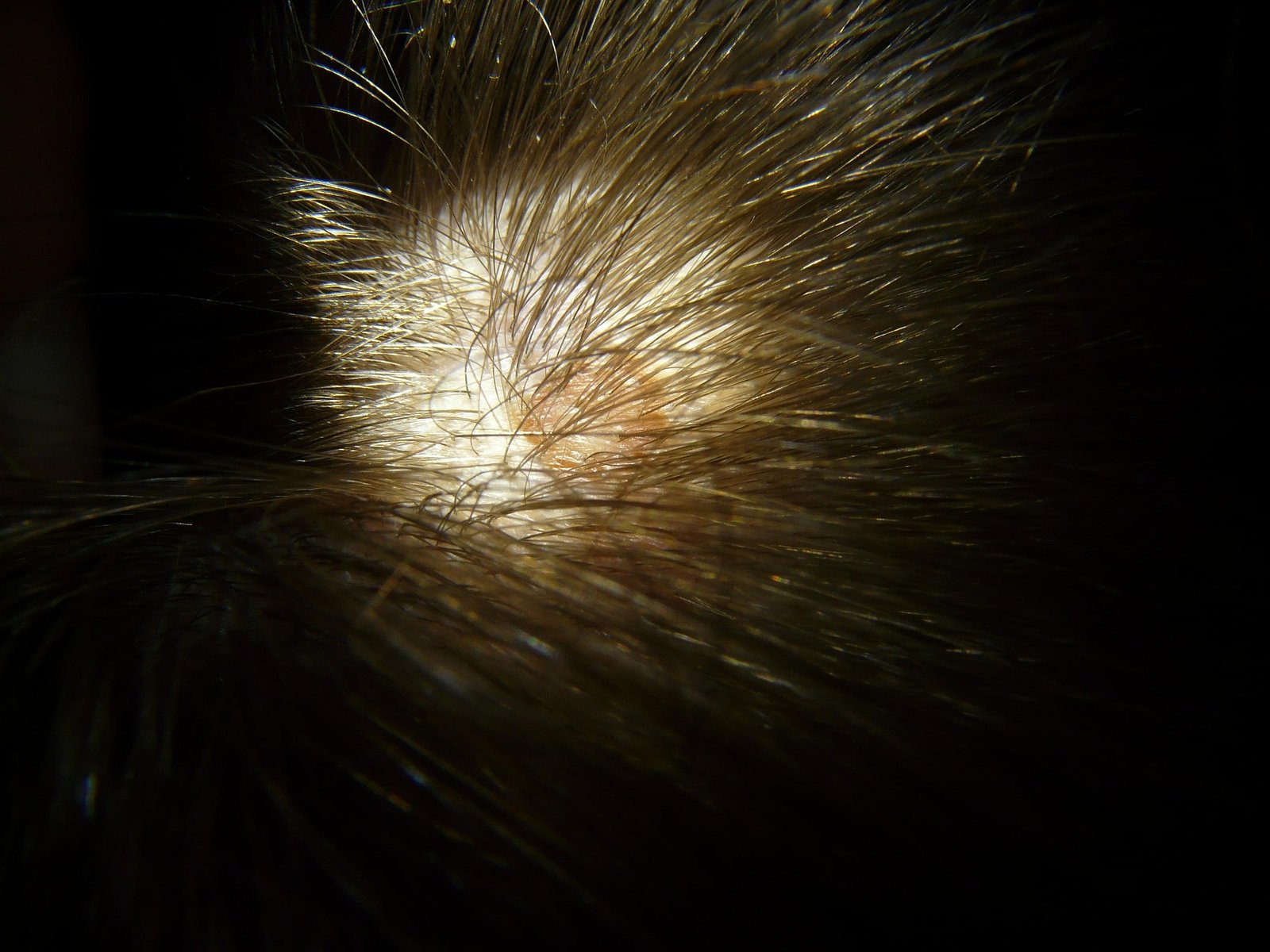 1 best scalp health tip and scalp massager